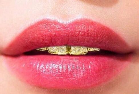 迪拜牙医用黄金钻石打造假牙